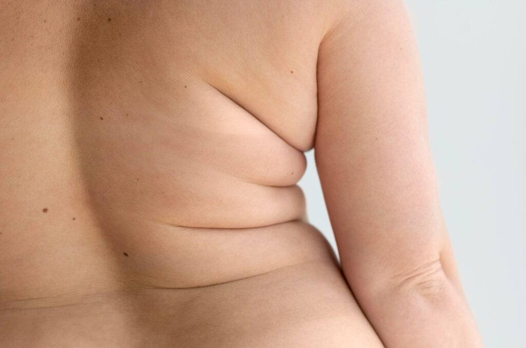 Are You Confident to Bare Your Back?