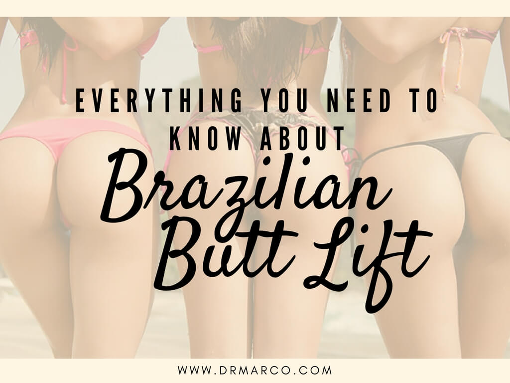 Everything You Need to Know About Brazilian Butt Lift
