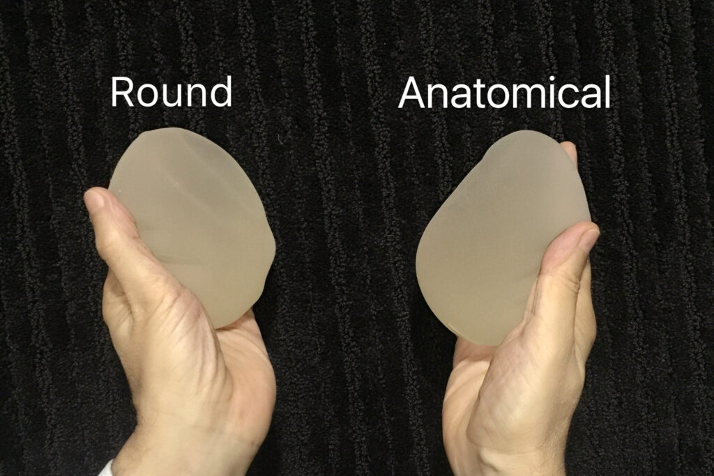 Round vs Anatomical Implants