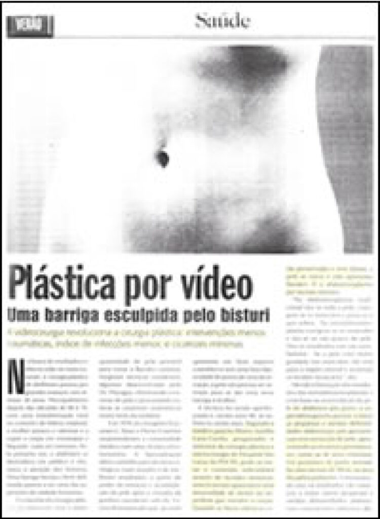 plastica por video black ang white article newsprint