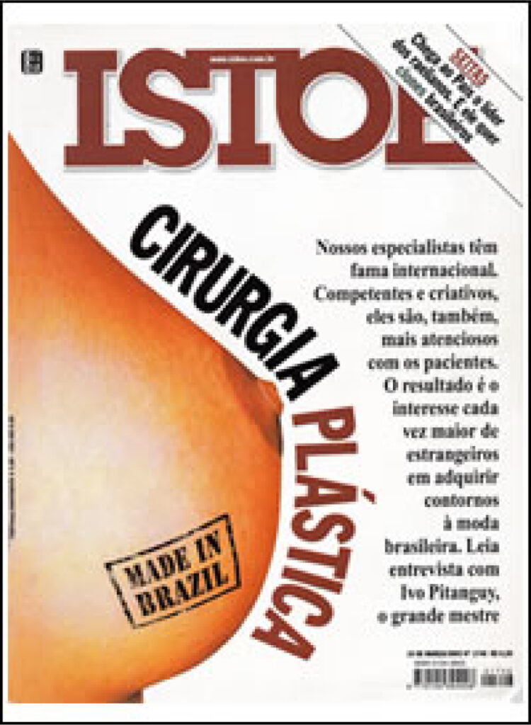brazillian plastic surgery magazine cover