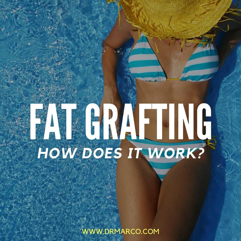 Dear Dr Marco, How Does Fat Grafting Work?