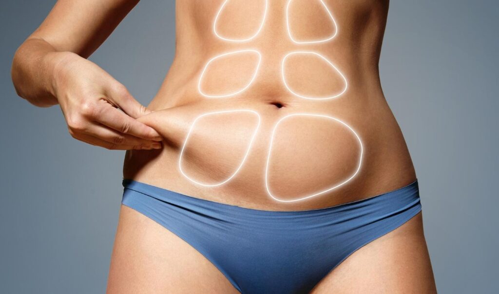 Tummy Tuck vs. Liposuction: What You Need To Know