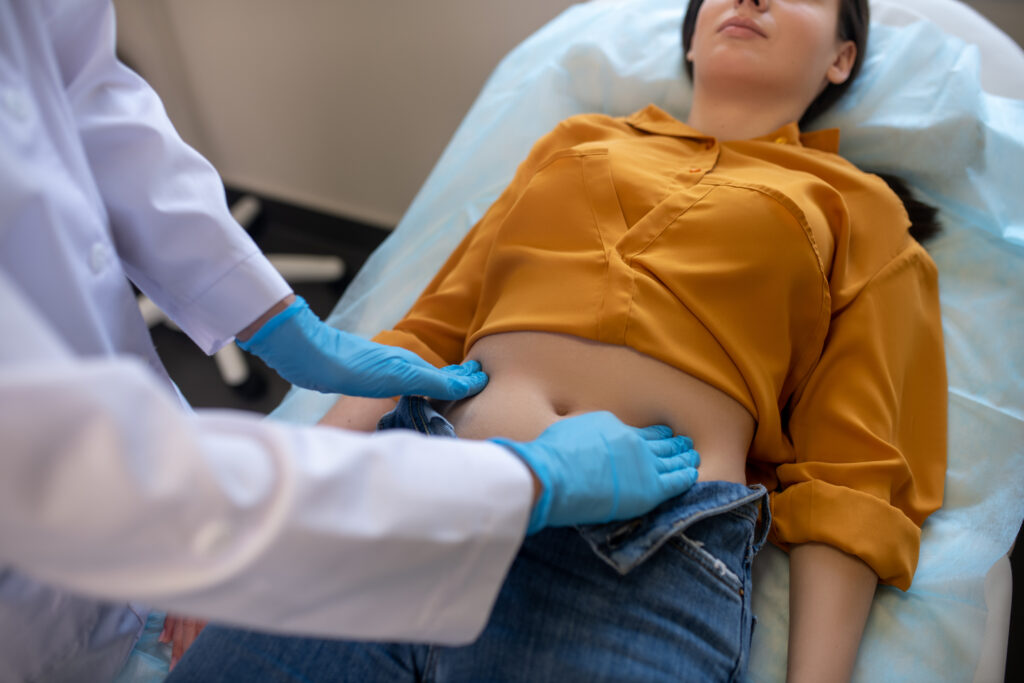 Treatment Options for Rectus Diastasis