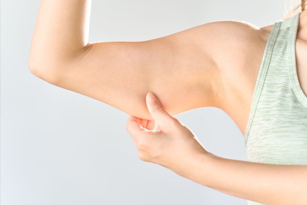 Arm Liposuction: A Comprehensive Guide