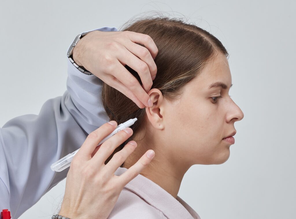 Otoplasty: A Plastic Surgeon’s Guide