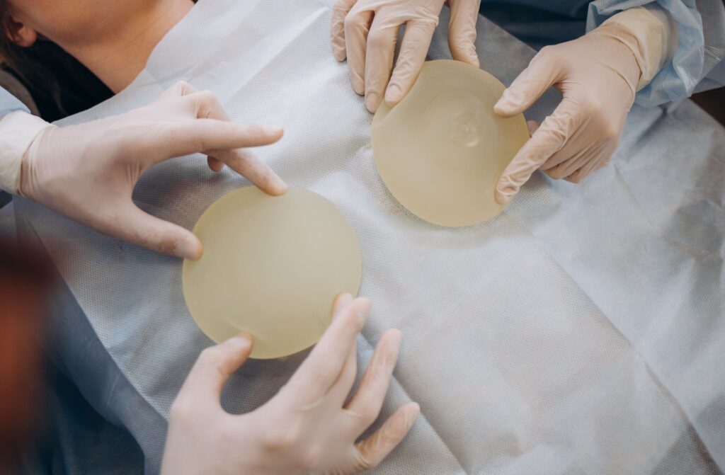 Second Breast Augmentation: What You Need to Know